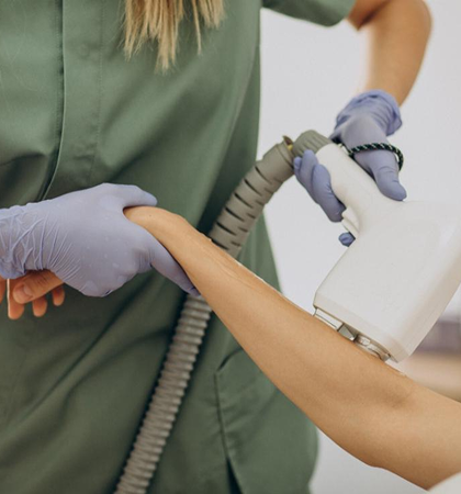 Hand Hair Removal 3 Laser treatment for hand hair removal in Kolkata